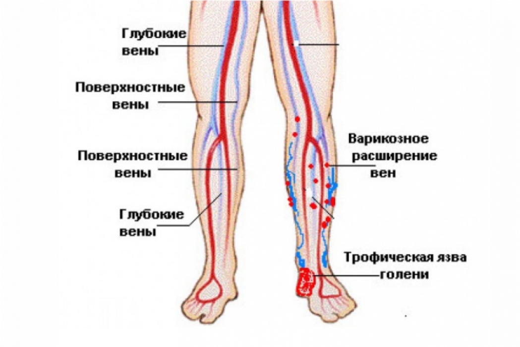Карта вен нижних конечностей. Сосуды нижних конечностей анатомия схема. Вены и артерии нижних конечностей схема. Вены нижней конечности анатомия варикоз. Сосуды нижних конечностей артерии и вены.